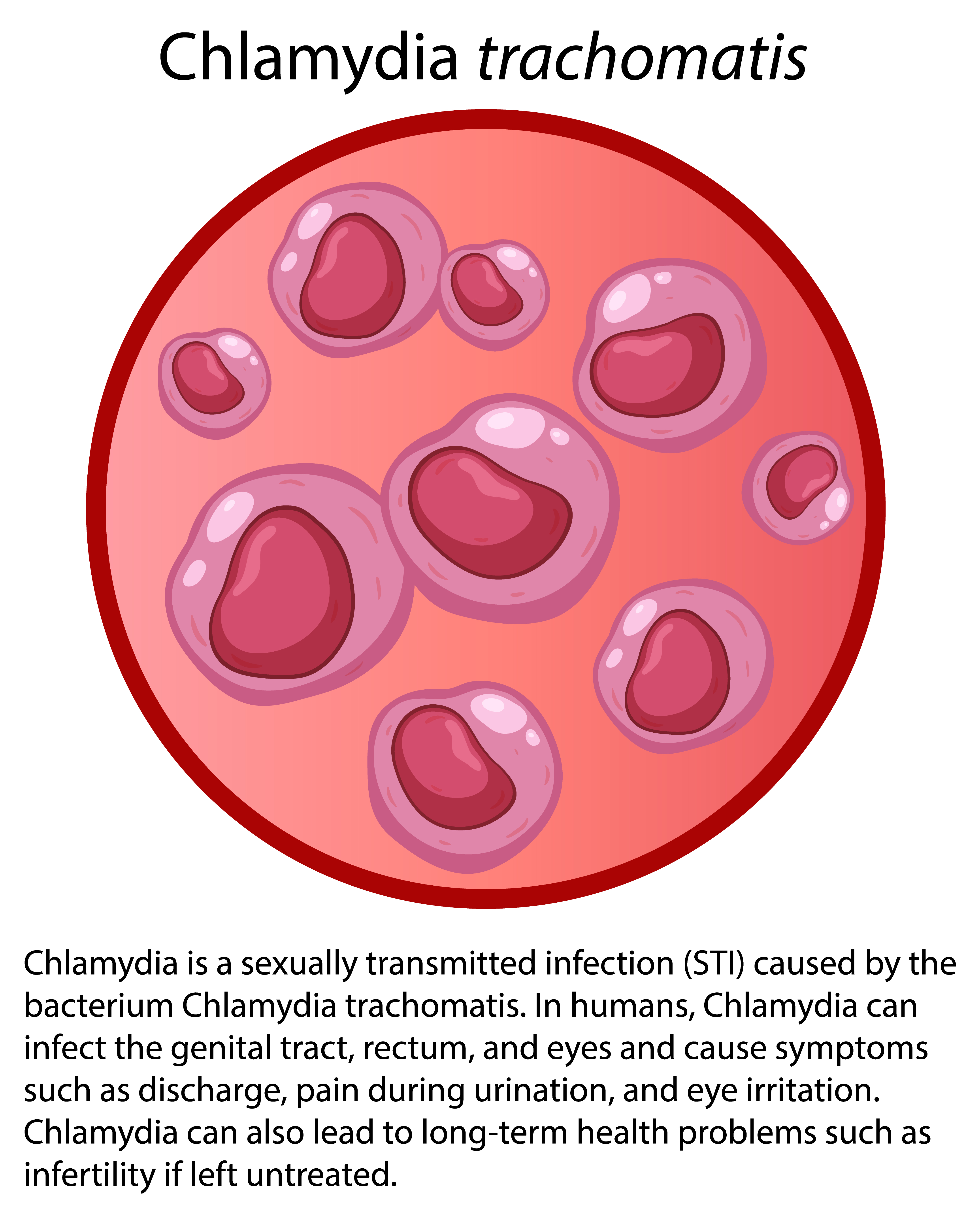 Urethral Stricture Combined with Urethral Scrotal Fistula Following Transurethral Resection of the Prostate: A Case Report and Literature Review