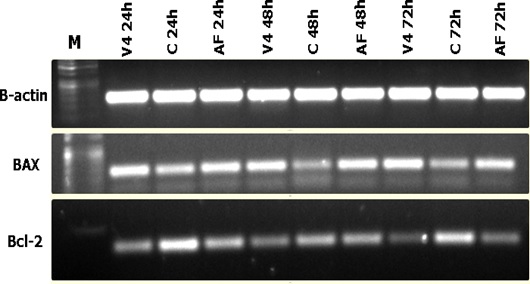 Apoptosis Induction of Newcastle Disease Virus Strains (AF 2240 & V4-UPM) on HT-29Human Colorectal Adenocarcinoma Cells