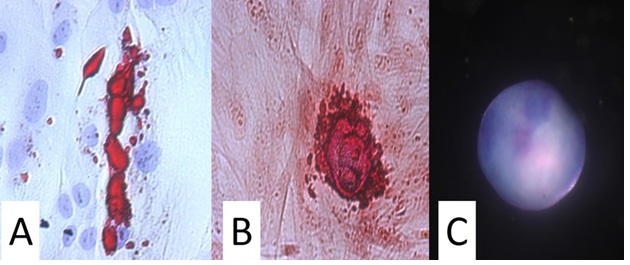 Beyond a “Pinch of this and a Handful of that:” Using Manufacturing Standards for the Isolation of Human Mesenchymal Stem Cells From Adipose Tissue- A Novel Point-of-Care Device