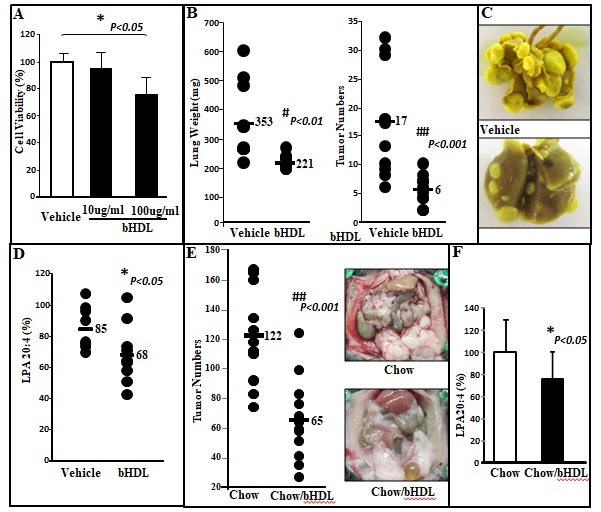 Bovine HDL and Dual Domain HDL-Mimetic Peptides Inhibit Tumor Develop- ment in Mice