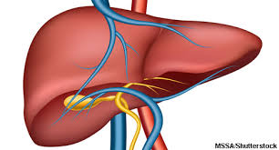 Acute Biliary Peritonitis - A Rare Case Report of Isolated Gall Bladder Gangrene Secondary to Coeliac Artery Thrombus