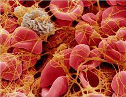 Effect of Cardiopulmonary Bypass Machine on the Platelet Function Testing Effect of Cardiopulmonary Bypass Machine on the Platelet Function Testing