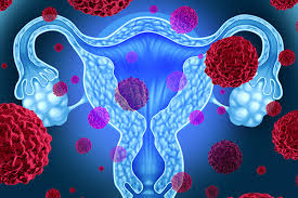 Therapeutic Decision on Adnexal Masses: A Performance Protocol Based on HE4 Tumor Marker (Human Epididymis Protein 4), GI-RADS (Gynecology Imaging Reporting and Data System) and Hormonal Status