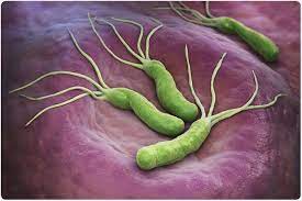 Nitazoxanide as Salvage Treatment for Refractory Helicobacter pylori Infections Nitazoxanide as Salvage Treatment for Refractory Helicobacter pylori Infections