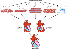 Heart Function and Ventricular Recovery after Percutaneous Closure of Peri-Membranous Ventricular Septal Defect in Children: A Cross-Sectional Study
