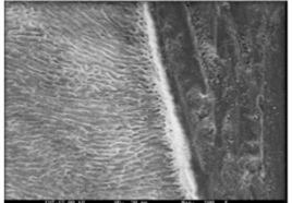 Effect of Dentin Biomodification on Resin Dentin Bond Strength